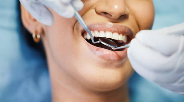 Best Walk-In Emergency Dentist in , IL